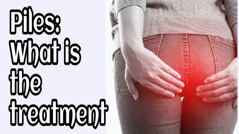 Piles: What is the treatment